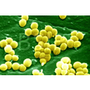 Show Tụ cầu-Staphylococcus Image